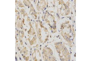 Immunohistochemistry of paraffin-embedded human stomach using STK11 antibody. (LKB1 antibody  (AA 134-433))