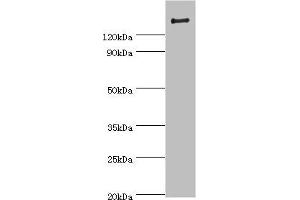 Western blot All lanes: ROCK2 antibody at 2 μg/mL + Rat brain tissue Secondary Goat polyclonal to rabbit IgG at 1/10000 dilution Predicted band size: 161 kDa Observed band size: 161 kDa