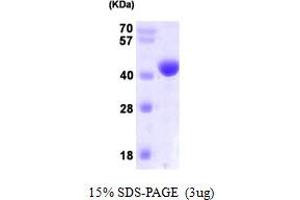 SDS-PAGE (SDS) image for N-Acetylneuraminic Acid Synthase (NANS) (AA 1-359) protein (His tag) (ABIN667265)