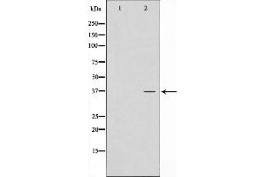 Western blot analysis on LOVO cell lysate using ATPBD3 Antibody，The lane on the left is treated with the antigen-specific peptide. (ATPBD3 antibody  (C-Term))