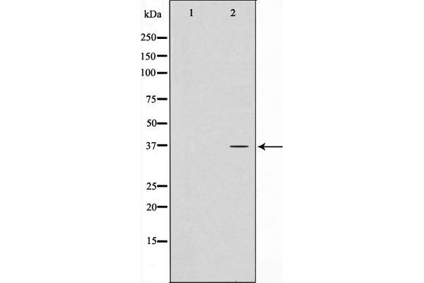 ATPBD3 Antikörper  (C-Term)