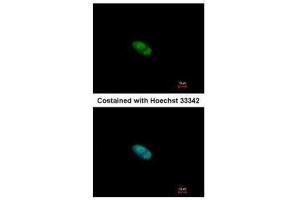 ICC/IF Image Immunofluorescence analysis of paraformaldehyde-fixed HeLa, using ZNF148, antibody at 1:500 dilution. (ZNF148 antibody  (N-Term))