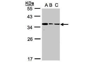 WB Image Sample(30 ug whole cell lysate) A:293T B:A431, C:H1299 12% SDS PAGE antibody diluted at 1:1000 (BPGM antibody)
