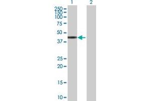 Western Blot analysis of ZNF331 expression in transfected 293T cell line by ZNF331 MaxPab polyclonal antibody.