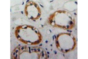 Used in DAB staining on fromalin fixed paraffin-embedded Kidney tissue (ENO1 antibody  (AA 267-354))
