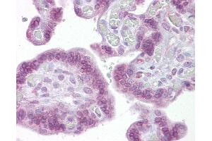 Anti-IRF6 antibody IHC of human placenta. (IRF6 antibody  (AA 395-444))