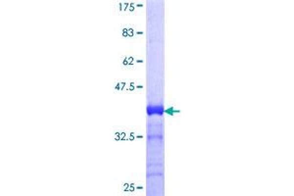 CACNA1S Protein (AA 1743-1838) (GST tag)