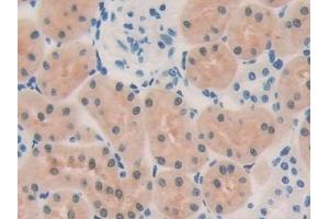 Detection of OIT3 in Rat Kidney Tissue using Polyclonal Antibody to Oncoprotein Induced Transcript 3 (OIT3) (OIT3 antibody  (AA 251-524))