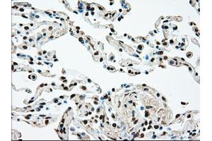 Image no. 2 for anti-Mitogen-Activated Protein Kinase Kinase 4 (MAP2K4) antibody (ABIN1499482) (MAP2K4 antibody)