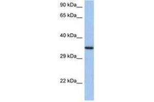 Image no. 1 for anti-HORMA Domain Containing 2 (HORMAD2) (AA 35-84) antibody (ABIN6743695) (HORMAD2 antibody  (AA 35-84))