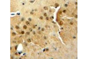 Used in DAB staining on fromalin fixed paraffin-embedded Brain tissue (DGKZ antibody  (AA 695-932))