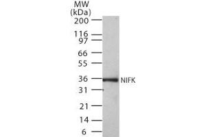 Western Blotting (WB) image for anti-MKI67 FHA Domain-Interacting Nucleolar Phosphoprotein (MKI67IP) (AA 100-200) antibody (ABIN208012) (NIFK antibody  (AA 100-200))