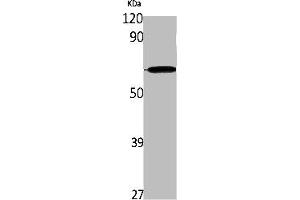 Western Blot analysis of K562 cells using IL-28Rα Polyclonal Antibody