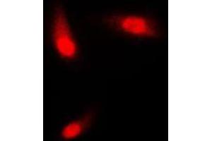 Immunofluorescent analysis of Cytokeratin 8 staining in NIH3T3 cells. (KRT8 antibody  (C-Term))
