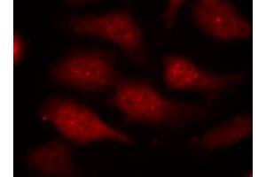 Immunofluorescence staining of methanol-fixed HeLa cells using CDK6 (phospho Y24) polyclonal antibody (Cat # PAB25915, red). (CDK6 antibody  (pTyr24))