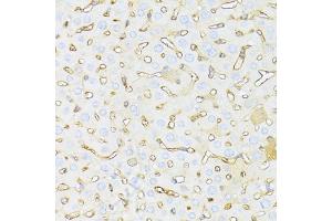 Immunohistochemistry of paraffin-embedded mouse liver using HAVCR2 antibody.