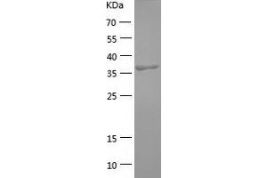 Western Blotting (WB) image for Complement Component (3b/4b) Receptor 1-Like (CR1L) (AA 41-405) protein (His tag) (ABIN7122467) (CR1L Protein (AA 41-405) (His tag))