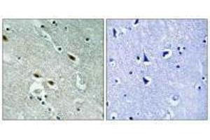 Immunohistochemistry analysis of paraffin-embedded human brain tissue using c-Met (Ab-1003) antiobdy. (c-MET antibody  (Tyr1003))