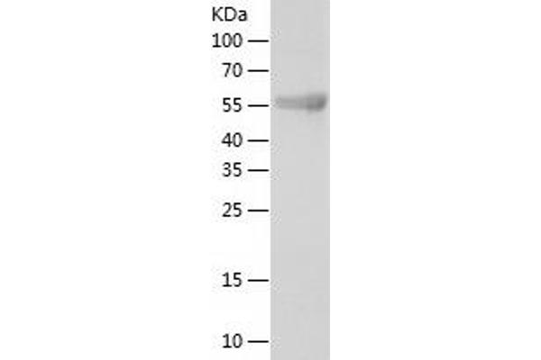 KLHL12 Protein (AA 1-568) (His tag)