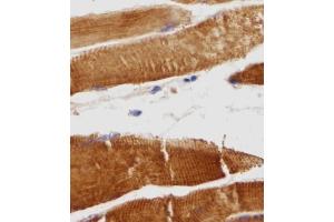 Immunohistochemical analysis of TITIN in Human skeletal muscle tissue sections(IHC-P - paraformaldehyde-fixed, paraffin-embedded sections). (Titin antibody  (N-Term))