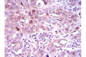 Immunohistochemistry (IHC) image for anti-ATP Citrate Lyase (ACLY) (AA 306-502) antibody (ABIN1098143)