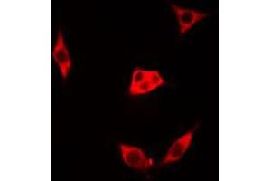 ABIN6273514 staining Hela cells by IF/ICC. (LGALS1/Galectin 1 antibody  (Internal Region))