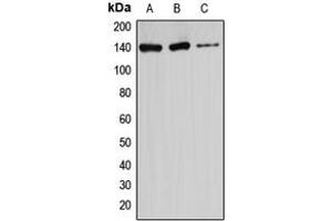 Western blot analysis of Ataxin 2 expression in HeLa (A), U87MG (B), Jurkat (C) whole cell lysates. (Ataxin 2 antibody  (Center))