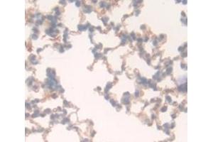 #VALUE! (FLT1 antibody  (AA 18-308))