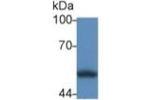 Western Blotting (WB) image for Calreticulin (CALR) ELISA Kit (ABIN6574281)