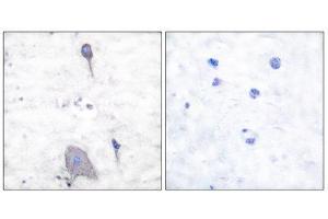 Immunohistochemistry (IHC) image for anti-Signal-Regulatory Protein alpha (SIRPA) (C-Term) antibody (ABIN1848773) (SIRPA antibody  (C-Term))