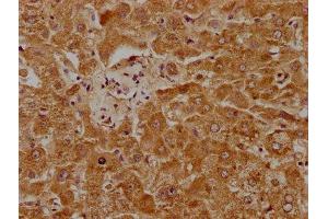 IHC image of ABIN7163540 diluted at 1:1000 and staining in paraffin-embedded human liver tissue performed on a Leica BondTM system. (PLG antibody  (AA 103-343))