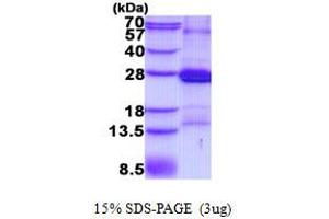 Image no. 1 for CD2 (CD2) protein (His tag) (ABIN1098728)