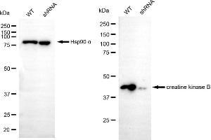 Western blotting analysis using creatine kinase B antibody (ABIN7798163).