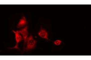 ABIN6275205 staining RAW264. (CEP97 antibody  (Internal Region))