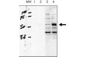 Western Blotting (WB) image for anti-Activin A Receptor Type II-Like 1 (ACVRL1) antibody (ABIN3003504) (ACVRL1 antibody)