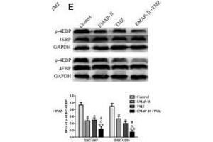 EMAP-II in combination with TMZ induced GSCs autophagy through MACC1 inhibiting PI3K/AKT/mTOR signaling pathway. (eIF4EBP1 antibody  (C-Term))