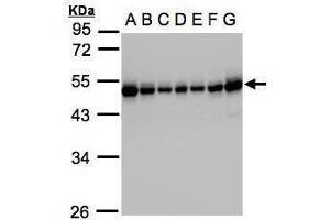 Western Blotting (WB) image for anti-Regulator of Chromosome Condensation 1 (RCC1) antibody (ABIN2855859)