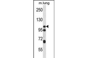 CTNND2 Antibody (C-term) (ABIN656479 and ABIN2845759) western blot analysis in mouse lung tissue lysates (35 μg/lane). (CTNND2 antibody  (C-Term))