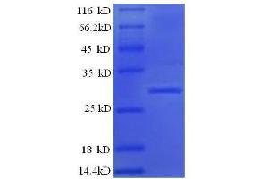 Kallikrein B, Plasma (Fletcher Factor) 1 (KLKB1) (AA 391-638) protein (His tag) (KLKB1 Protein (AA 391-638) (His tag))