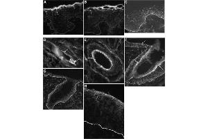 Immunohistochemistry detection of human cornulin using anti-Cornulin (human) (ABIN1169072). (CRNN antibody  (AA 259-274))