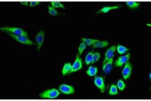 Immunofluorescent analysis of HepG2 cells using ABIN7147899 at dilution of 1:100 and Alexa Fluor 488-congugated AffiniPure Goat Anti-Rabbit IgG(H+L) (Claudin 2 antibody  (AA 29-81))