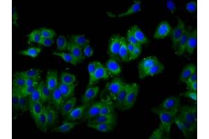 Immunofluorescence staining of HepG2 cells with ABIN7175220 at 1:100, counter-stained with DAPI. (TCIRG1 antibody  (Isoform 3))