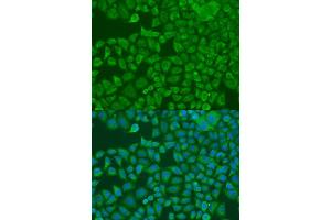 Immunofluorescence analysis of U2OS cells using FXR2 antibody. (FXR2 antibody  (AA 550-650))