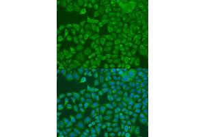 Immunofluorescence analysis of U2OS cells using FXR2 antibody. (FXR2 antibody  (AA 550-650))