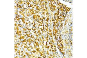 Immunohistochemistry of paraffin-embedded rat ovary using V antibody (ABIN6130774, ABIN6150046, ABIN6150047 and ABIN6224821) at dilution of 1:100 (40x lens). (VAMP1 antibody  (AA 1-96))