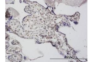 Image no. 4 for anti-Decapping Enzyme, Scavenger (DCPS) (AA 1-338) antibody (ABIN466201) (DCPS antibody  (AA 1-338))