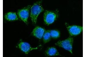 IF analysis of GPR54/KISS1R using anti-GPR54/KISS1R antibody (ABIN7602153). (KISS1R antibody  (AA 60-373))