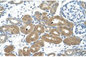 Immunohistochemistry (IHC) image for anti-Forkhead Box P2 (FOXP2) (N-Term) antibody (ABIN2778104) (FOXP2 antibody  (N-Term))