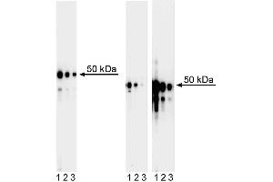 Western blot analysis of GATA3 in human T leukemia and mouse T helper cells.