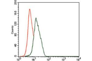 Immunohistochemical analysis of paraffin-embedded liver cancer tissues using ENO2 antibody with DAB staining. (ENO2/NSE antibody  (AA 251-433))